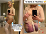 Дана Борисова опубликовала фото после липосакции спины, рук и ягодиц
