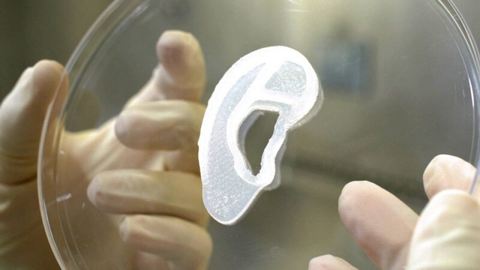 3D-напечатанное ухо из собственных клеток пациента