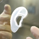 Женщине впервые пересадили 3D-напечатанное ухо из ее собственных клеток	