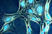 Фибробласты