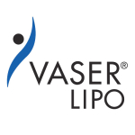 VASER липосакция