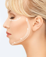 Подтяжка лица нитями