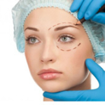 samye_populyarnye_operatzii_2014