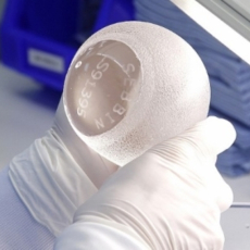 vybor_grudnyh_implantov