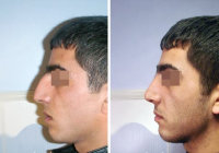 Gevorg_Egiazaryan_do_i_posle_rino