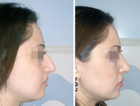 Gevorg_Egiazaryan_do_i_posle_rino