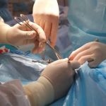 videokamery_v_operatcionnoy