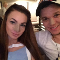 Евгения Феофилактова и Антон Гусев после ринопластики