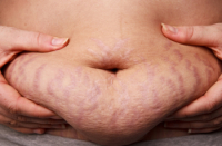 Живот после родов