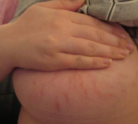 Грудь после родов