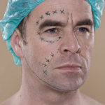 Насколько пластическая хирургия популярна среди мужчин