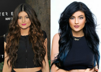 Кайли Дженнер до и после пластики