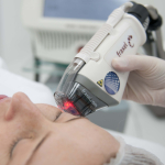 Fraxel: фракционный фототермолиз