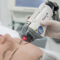 Fraxel: фракционный фототермолиз