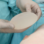 Валерий Стайсупов об увеличении груди с помощью имплантов