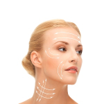 Можно ли делать круговую подтяжку лица после нитевого лифтинга?