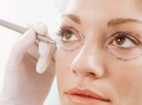 Блефаропластика: часто задаваемые вопросы