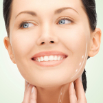 Подтяжка нитями Силуэт Лифт