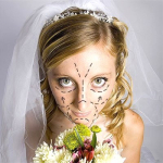 Новая тенденция: предсвадебная пластика