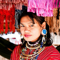 Пластика мочки уха