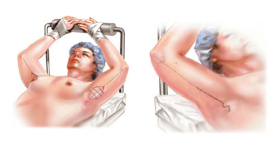 Пластика рук у Александра Гуляева