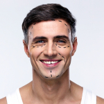 Модные тренды в пластической хирургии