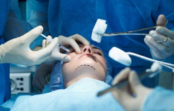 Пластика лица