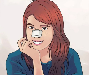 Восстановление после ринопластики