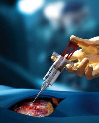 Бесшовные пластические операции