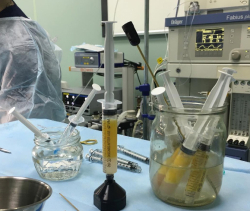 Липофилинг голеней