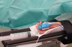 Эндоскопическая подтяжка Стайсупов