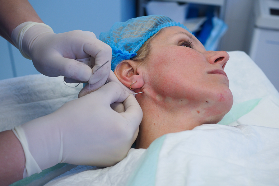 Олег Солдатов проводит процедуру подтяжки нитями