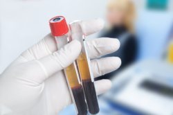 Олег Солдатов плазмолифтинг EMC