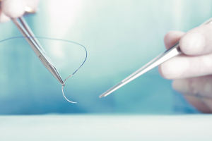 Нити для пластических хирургов