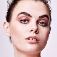 Пластика век в Real Clinic