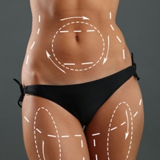 Отечность после липосакции: нормальное заживление и отклонения от нормы