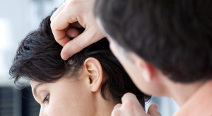 Как проводится пересадка волос?