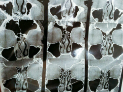 Томография носовых пазух