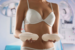 Маммопластика после 30 лет