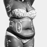 Липосакция Body-Jet избавит от лишнего жира