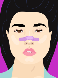 Ринопластика