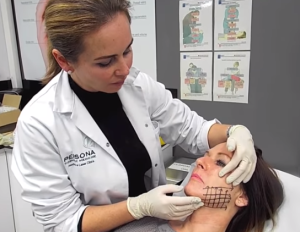 Тредлифтинг