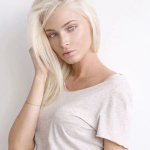 Алена Шишкова и ее пластические операции