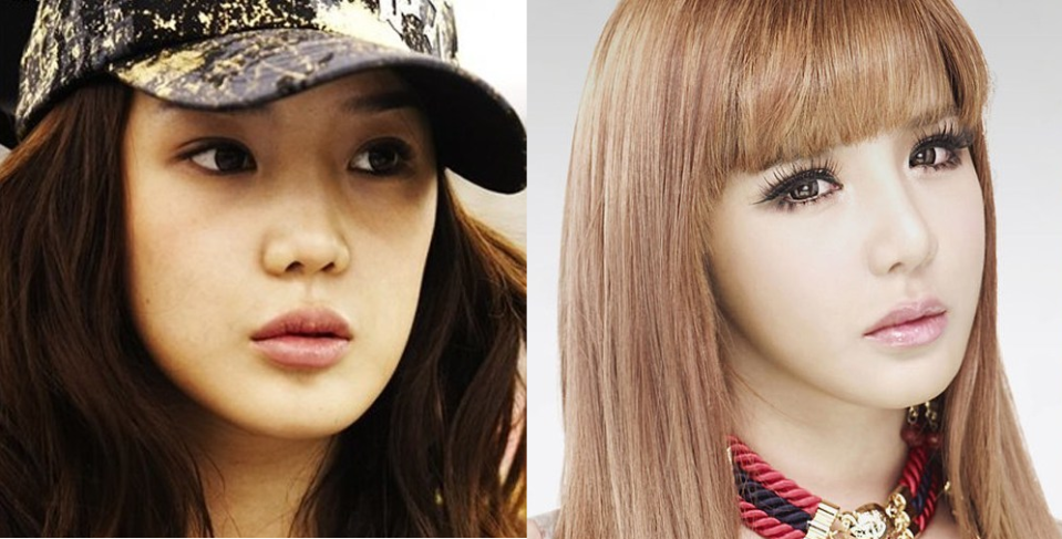 Корейские айдолы до и после пластики