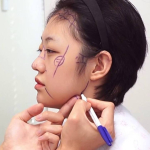 Китайские туристы чаще всех жалуются на корейских хирургов