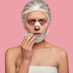 Синяки после ринопластики