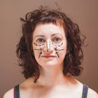 Давайте без ран: эндоскопический фейслифтинг