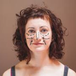 Давайте без ран: эндоскопический фейслифтинг