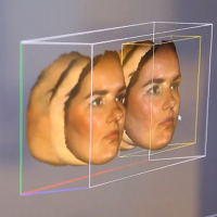 Как предугадать результат пластической операции?