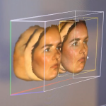 Как предугадать результат пластической операции?